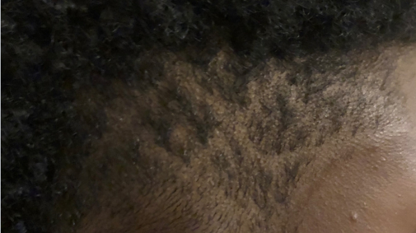 hair with lines cut in